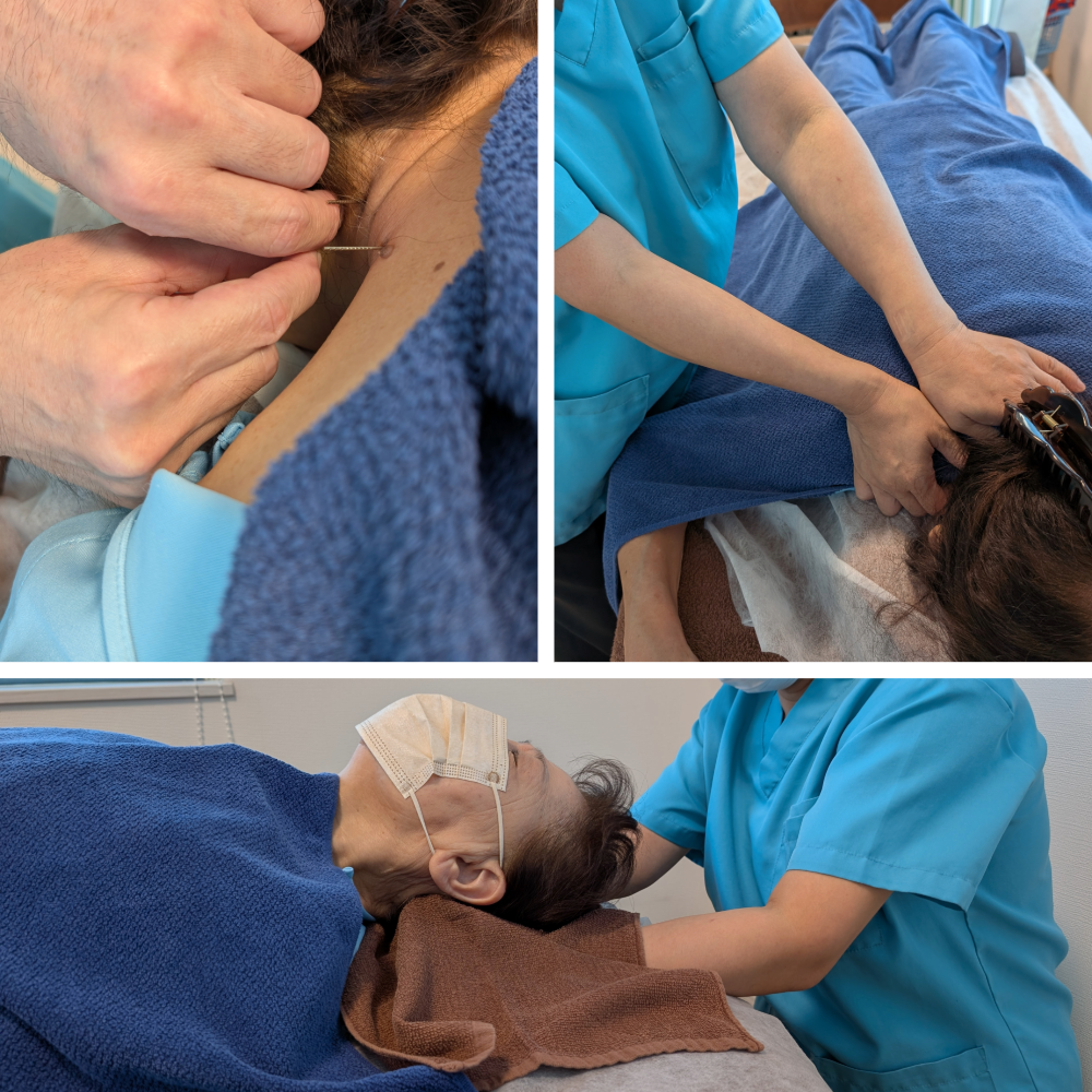 青空堂はりきゅうマッサージ院 【つらい頭痛に】健康コース（頭痛ケア　頭部に、はりきゅう＋マッサージ）のメニュー画像