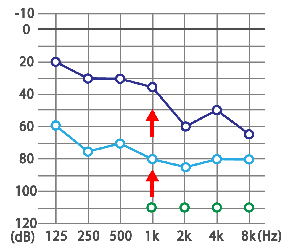 難聴、めまい・起立性調節障害・腰痛・肩の痛み・薄毛なら当院にお任せください！ともろ鍼灸院（剛鍼灸院グループ） 難聴は１日でも早い治療が大切！のメニュー画像