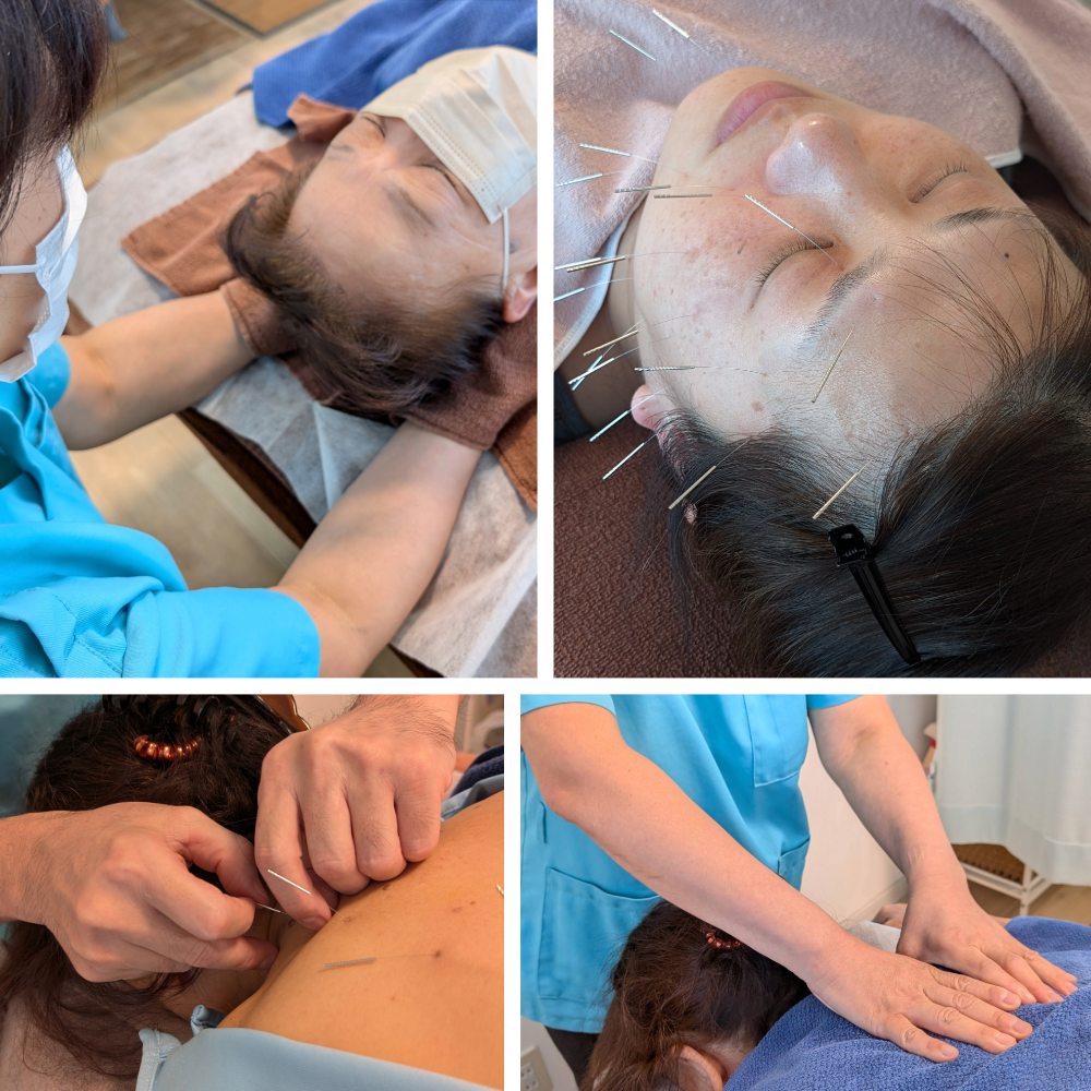 青空堂はりきゅうマッサージ院 【健康と美容がセット！】美容コース（肩こりケア＋美顔はり）のメニュー画像