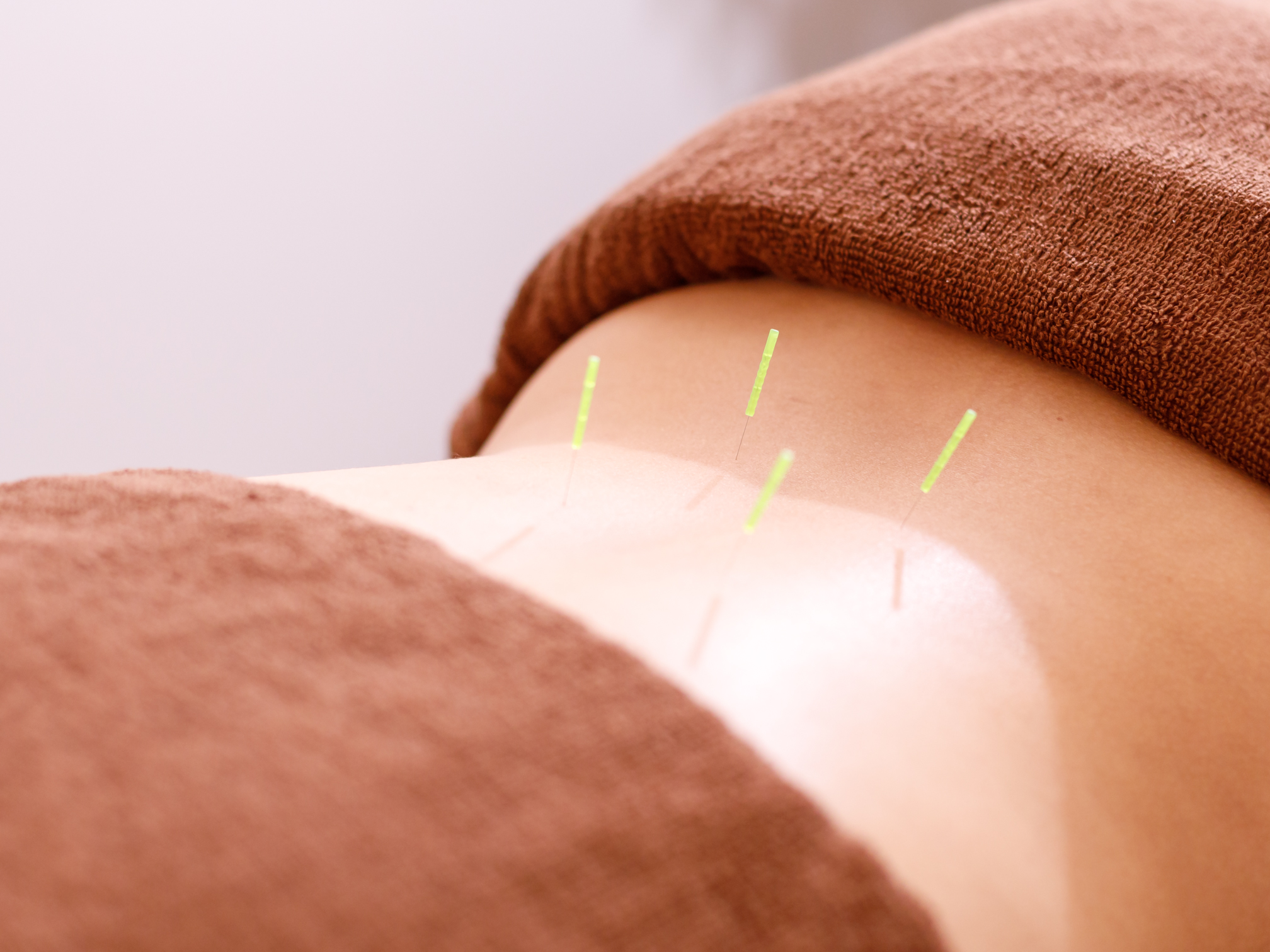 整体と美容鍼　無名 【頭からつま先まで全身鍼】　熟練鍼灸師による本格施術を！のメニュー画像