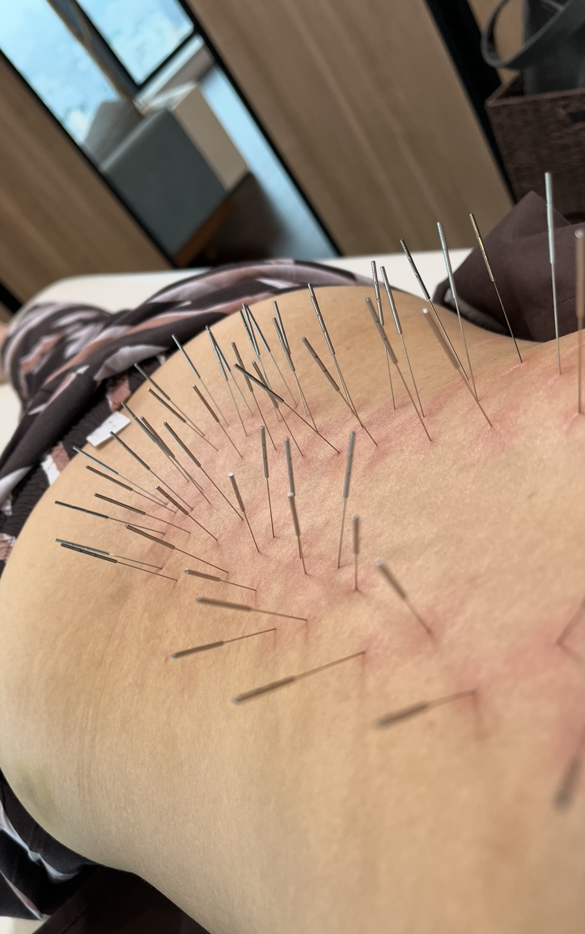 鍼処FUJINUMA 栃木院 鍼治療　80分のメニュー画像