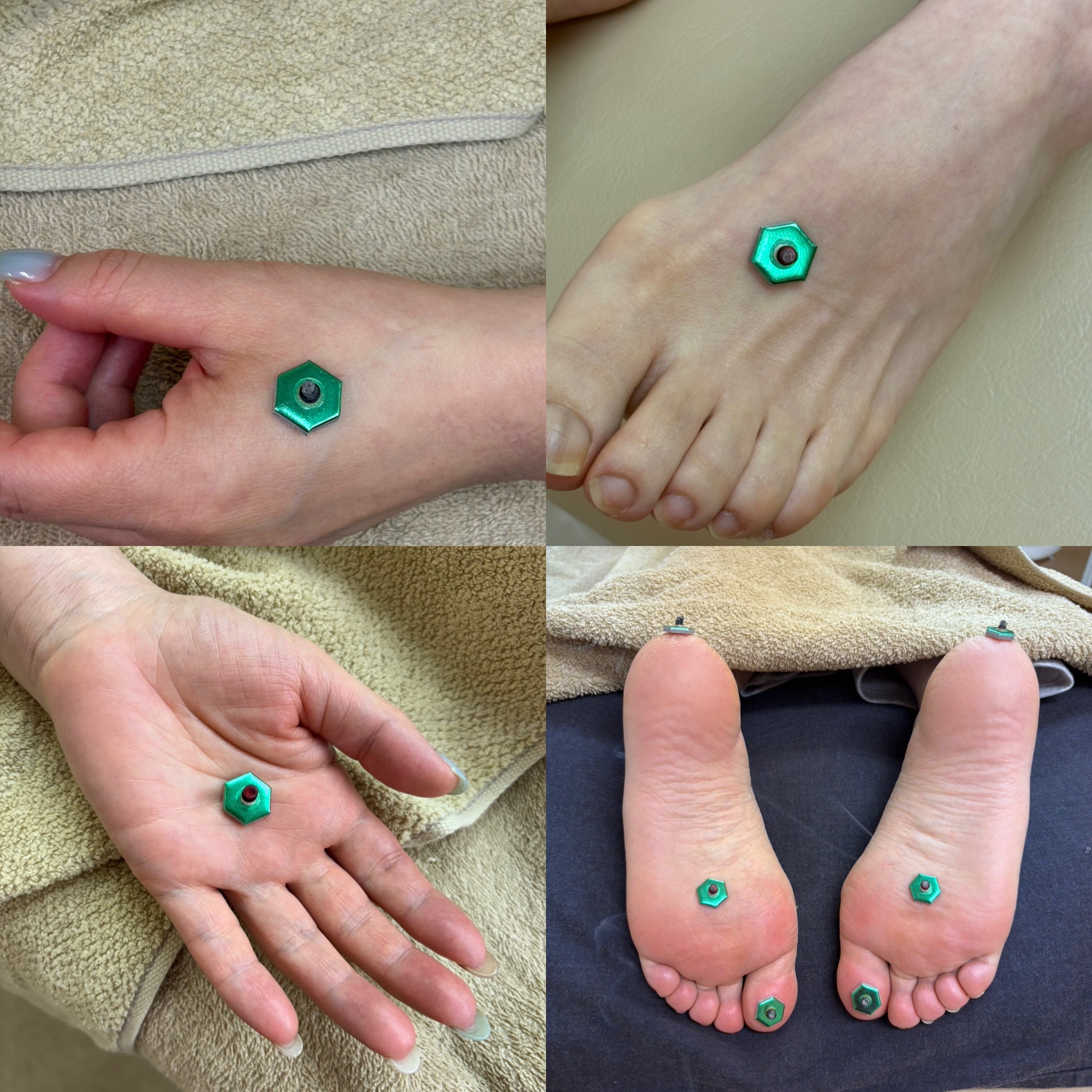 ルート治療専門　ながえ鍼灸院 お灸のメニュー画像