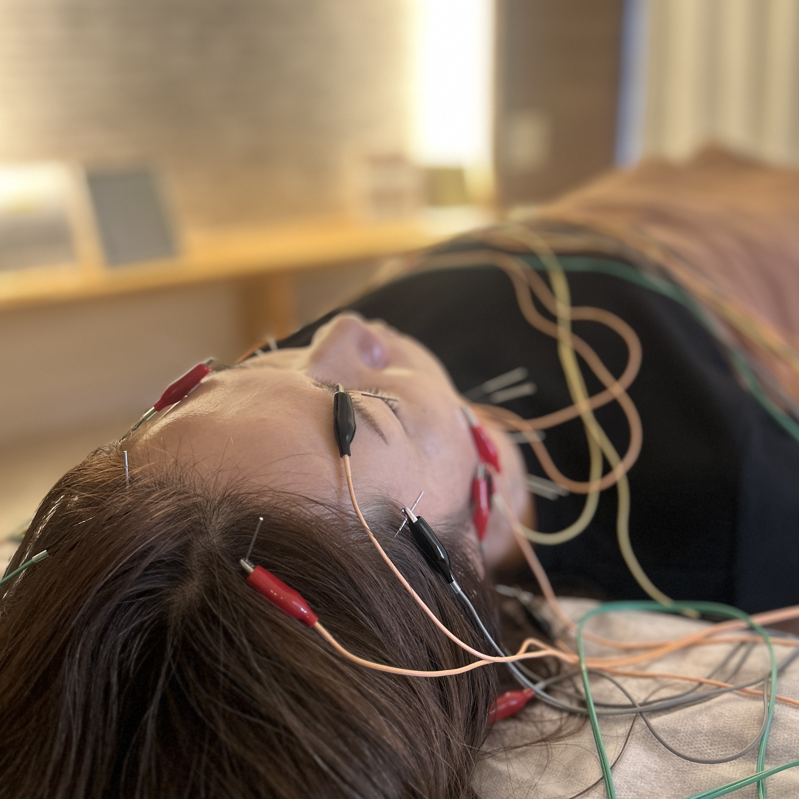 コトハリ 【人気No.2】 ご新規様 →電気を流す美容鍼 のメニュー画像