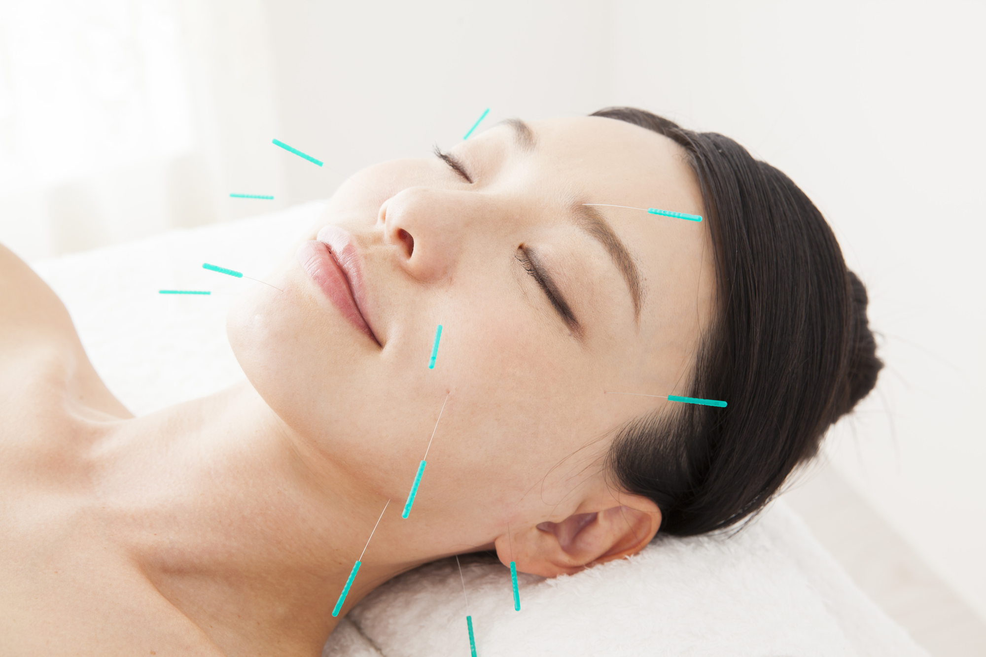 あかつき鍼灸接骨院　上福岡院 【美容鍼灸】顔全体コース＋ヘッドスパのメニュー画像