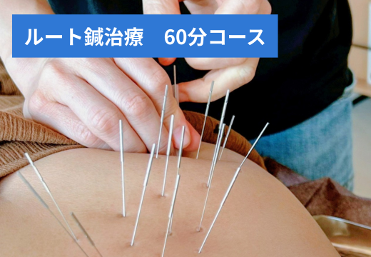はり灸マッサージSOLE LUNA ルート鍼（多鍼）治療60分　改善効果：GOODのメニュー画像