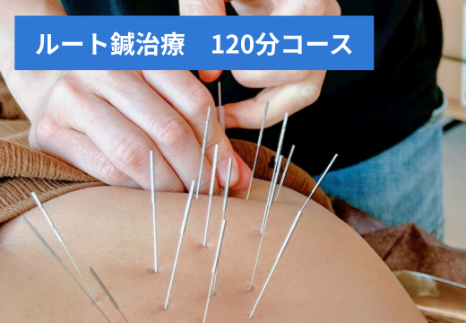 はり灸マッサージSOLE LUNA ルート鍼（多鍼）治療120分　改善効果：BESTのメニュー画像