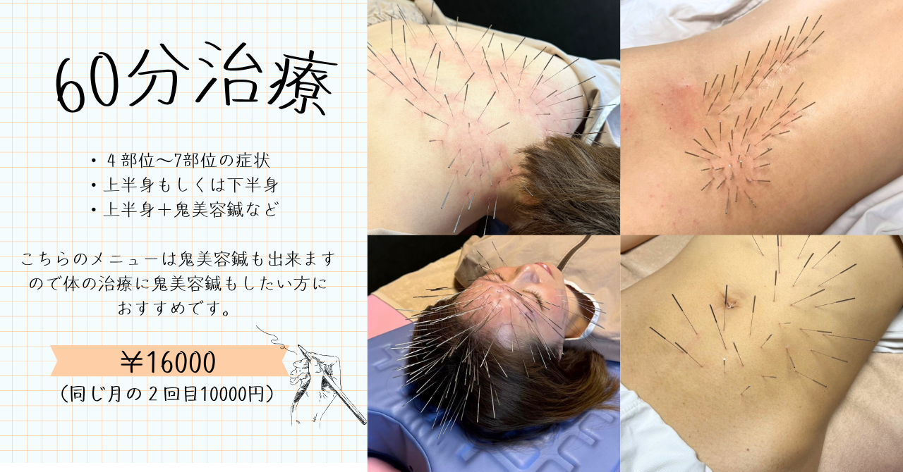 HARI CARE AURUM香川県丸亀市土器町【首肩コリ腰痛/不妊治療】 ただ今閉院中/スタンダード60分治療【200本から300本程度】のメニュー画像