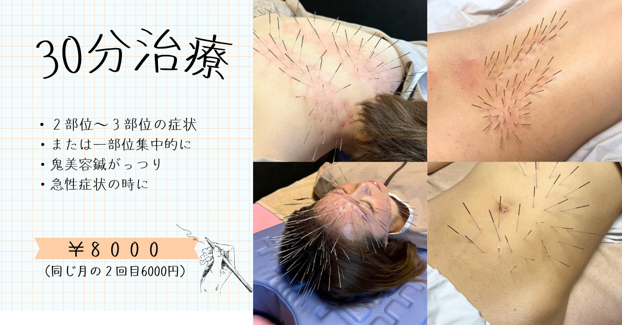 HARI CARE AURUM香川県丸亀市土器町【首肩コリ腰痛/不妊治療】 ただ今閉院中/ショート30分治療【100本以上打ちます】のメニュー画像