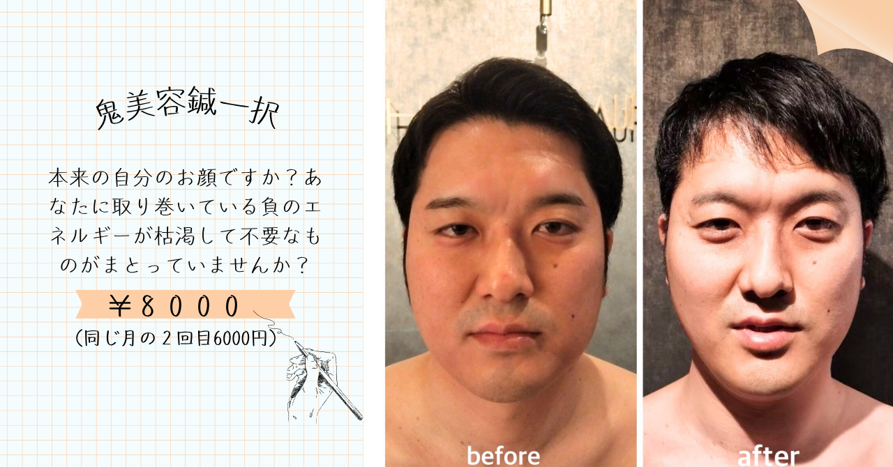 HARI CARE AURUM香川県丸亀市土器町【首肩コリ腰痛/不妊治療】 ただ今閉院中/鬼美容鍼【浮腫/ほうれい線/シワ/たるみ/お顔の悩み全般対応可能】のメニュー画像