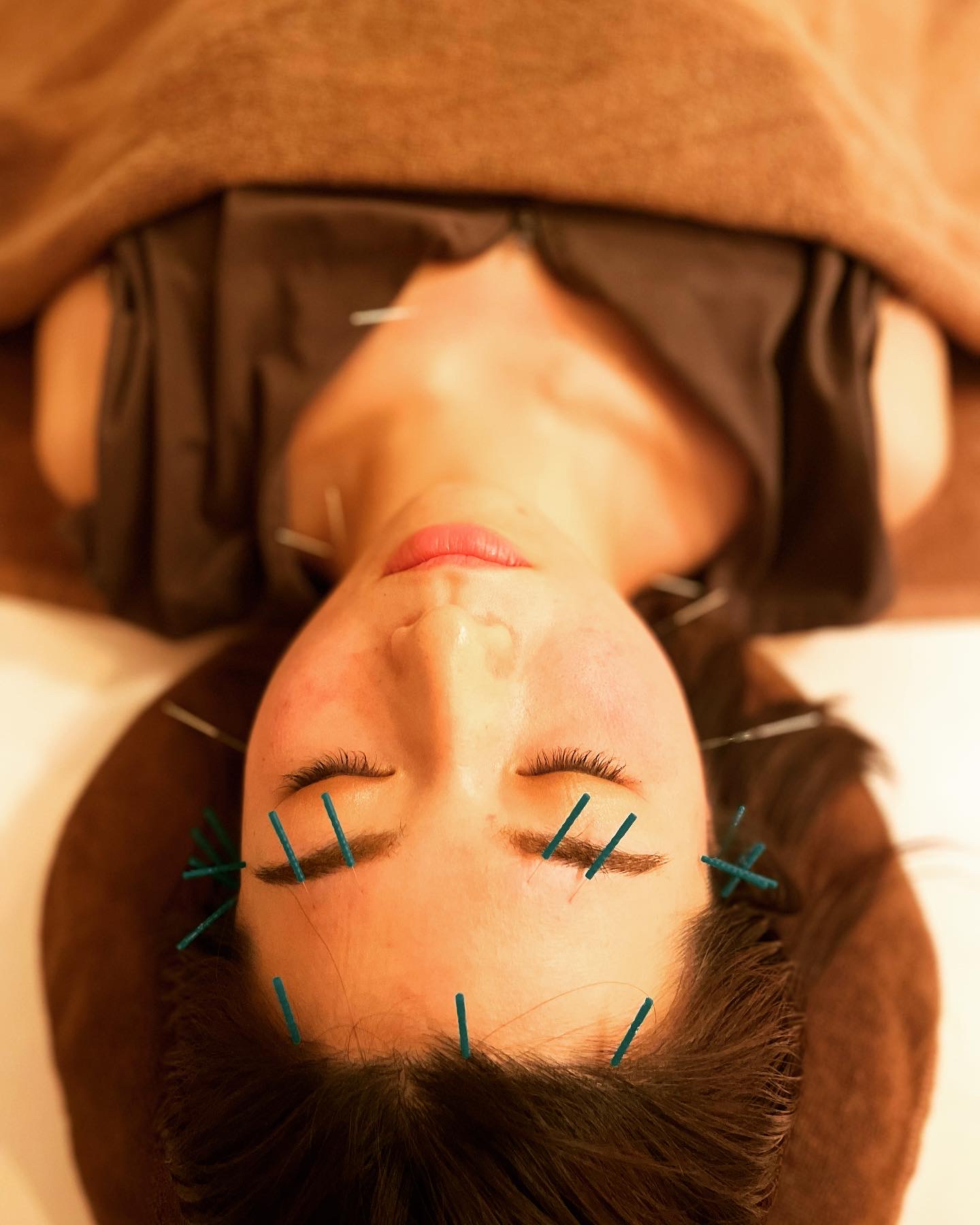 Asi鍼灸院 【ほうれい線・たるみ・お顔スッキリ美容鍼コース】のメニュー画像