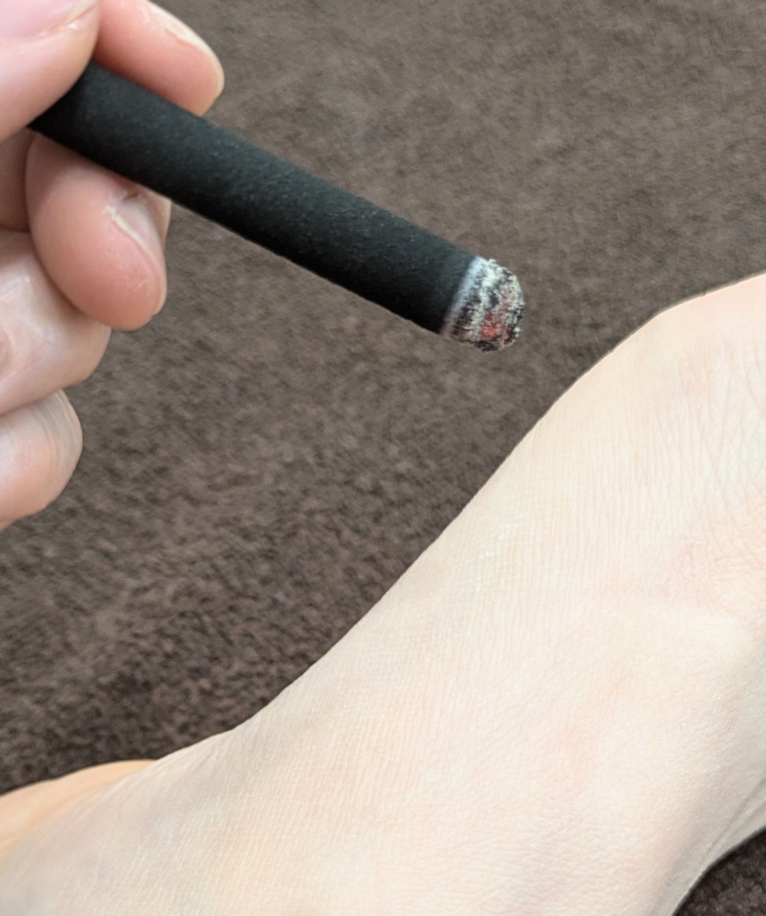 はり灸　Mysig お身体の鍼灸＋美容鍼のメニュー画像