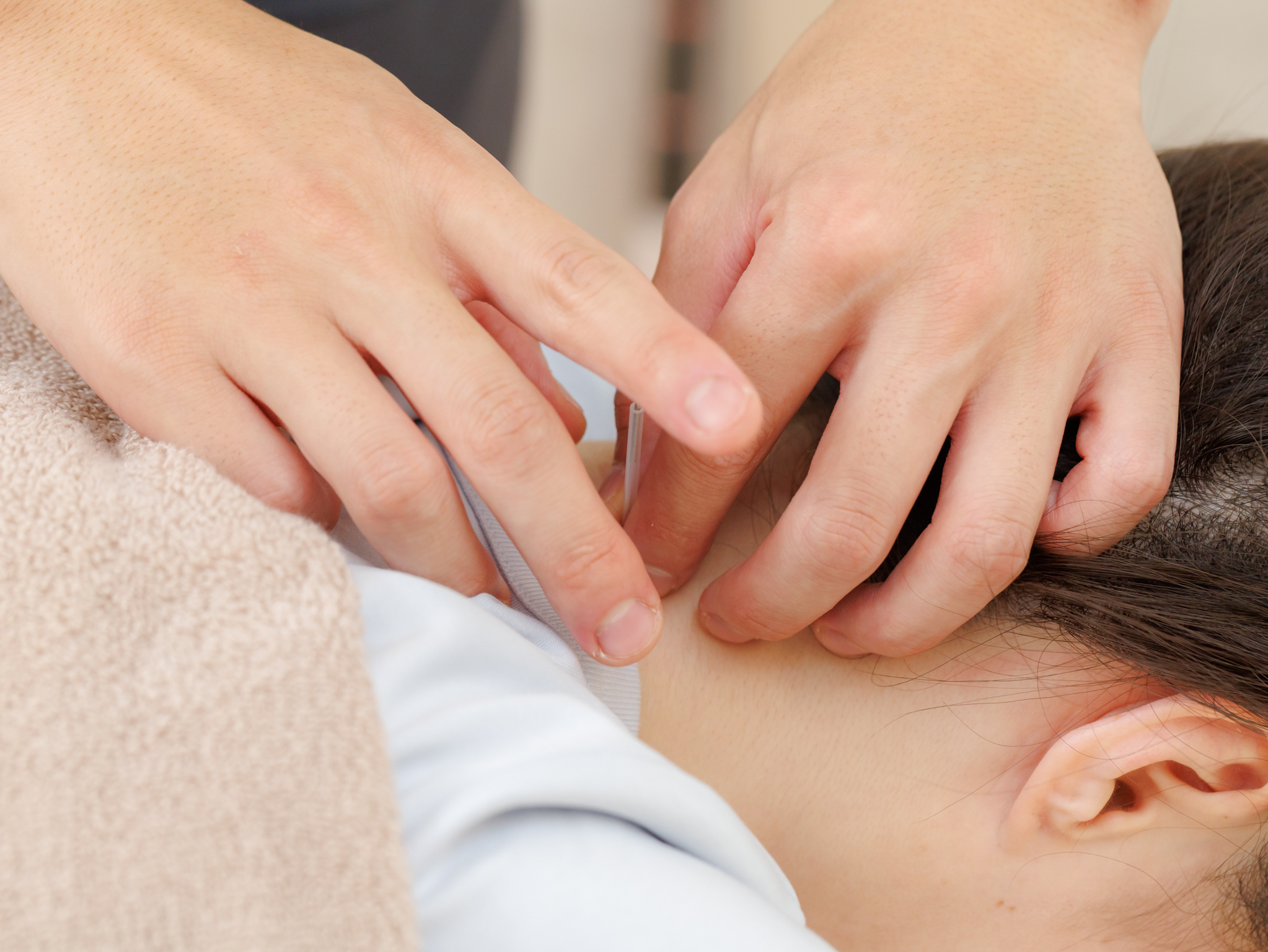 【八王子の肩こり/腰痛/ひざ痛】鍼灸整体ハリデイズ ハリデイズ式鍼コースのメニュー画像