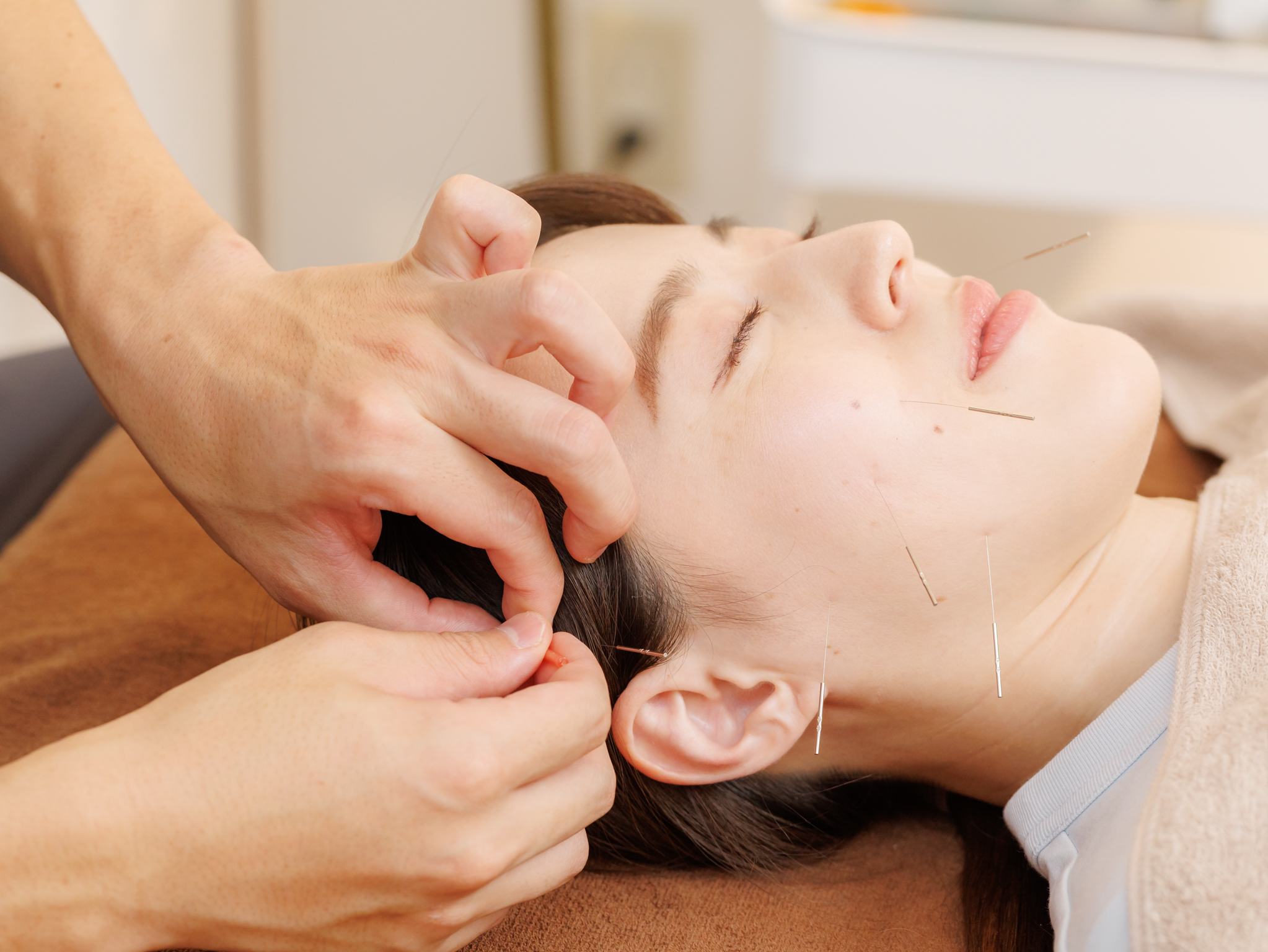 【八王子の肩こり/腰痛/ひざ痛】鍼灸整体ハリデイズ たるみ改善/むくみ◎ハリデイズ式美容鍼×小顔矯正コースのメニュー画像