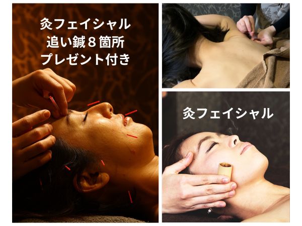 カリスタ恵比寿本店 【初回】美容鍼灸トライアルコース（灸フェイシャル＋追い鍼８箇所付き）のメニュー画像