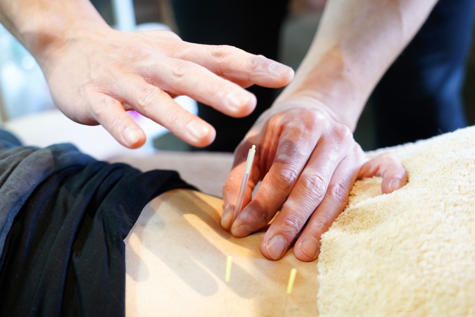 Fany整体鍼灸院 【2回目以降】鍼施術+整体 50分のメニュー画像