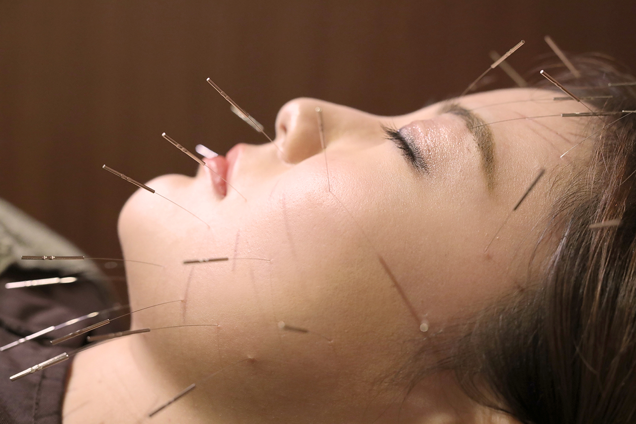 ORIENT THERAPY 秘鍼・鬼神美容鍼・電気美容鍼・ルート治療(認定院)レディース鍼・難聴特化型鍼サロン 秘鍼+α  (ベーシック+眼精疲労+美顔器のメニューの一つEMS・ラジオ波・ていしん)のメニュー画像