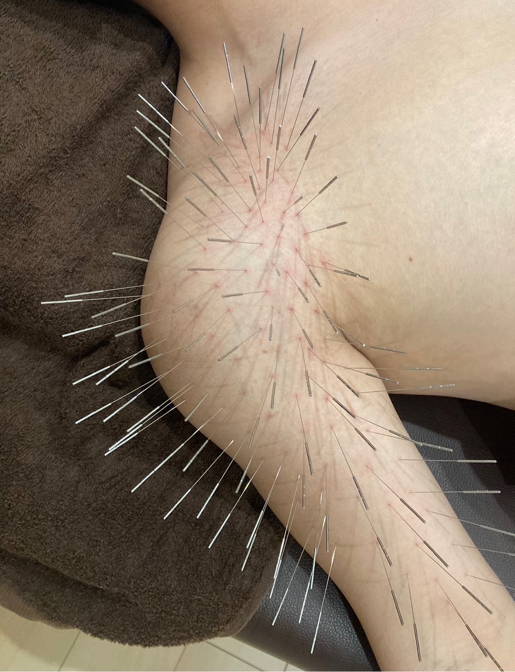 ここゆ鍼灸院 ルート治療１枠のメニュー画像