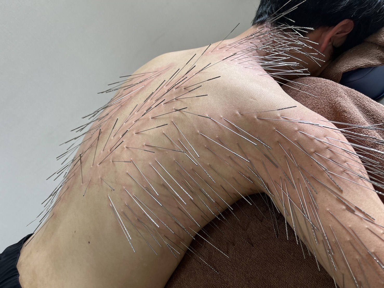 ここゆ鍼灸院 ルート治療｜２枠のメニュー画像