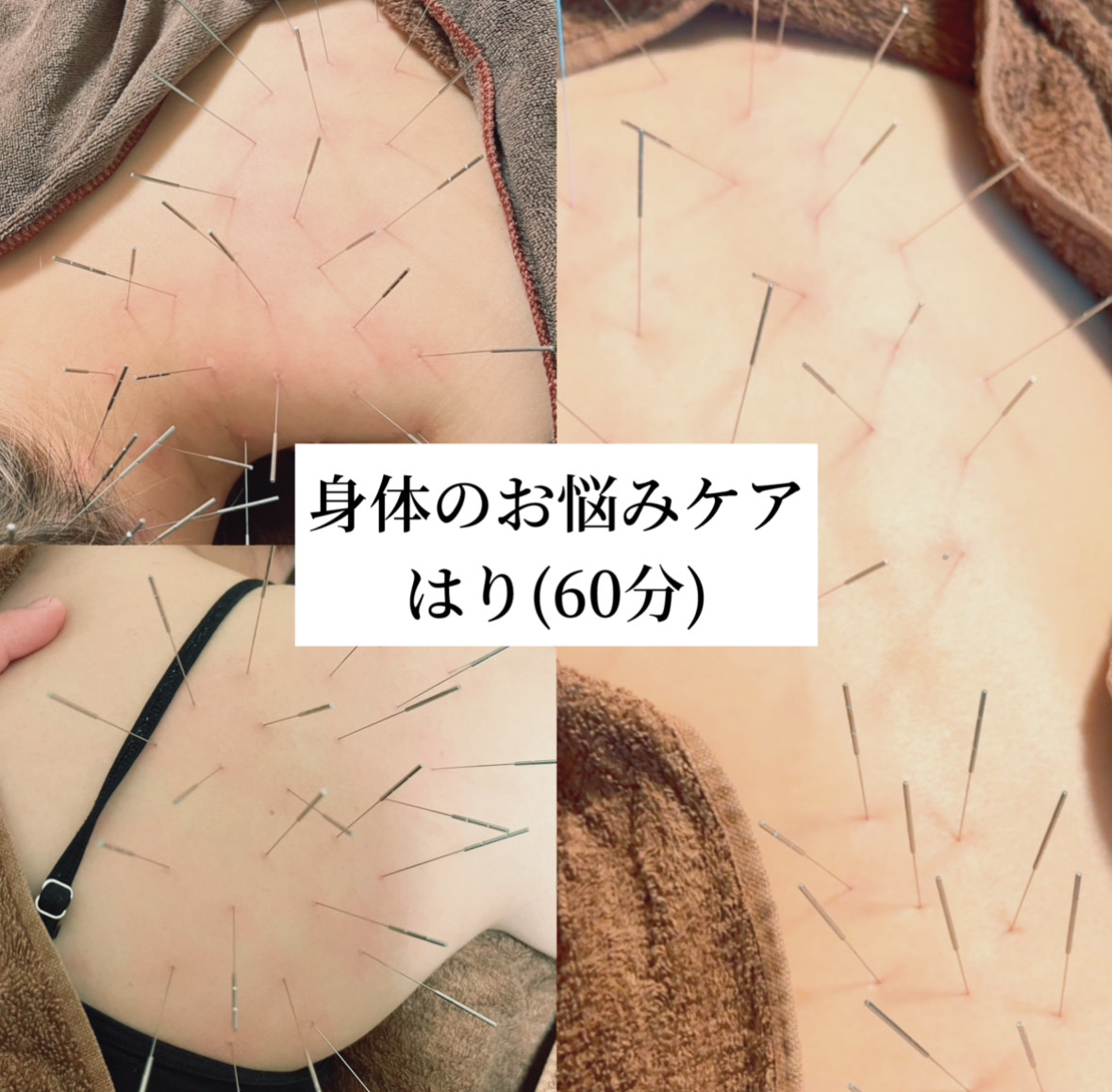 はり灸こころね 澄 - Sumi - Lucence 60分 (鍼・身体のお悩みケア)のメニュー画像