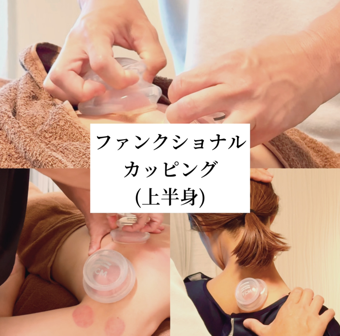 はり灸こころね 翔 - Sho - 40分 ファンクショナルカッピング® (上半身)のメニュー画像
