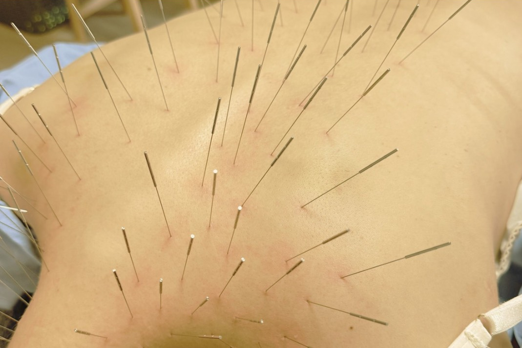 鍼処卓-taku- ｜ルート治療Sランク公認認定院｜空ルート｜浄化｜美容鍼｜吹田市 ルート治療（鍼と空ルート）　初診コース※前回の受診から3ヶ月空いた方は初診となります。のメニュー画像