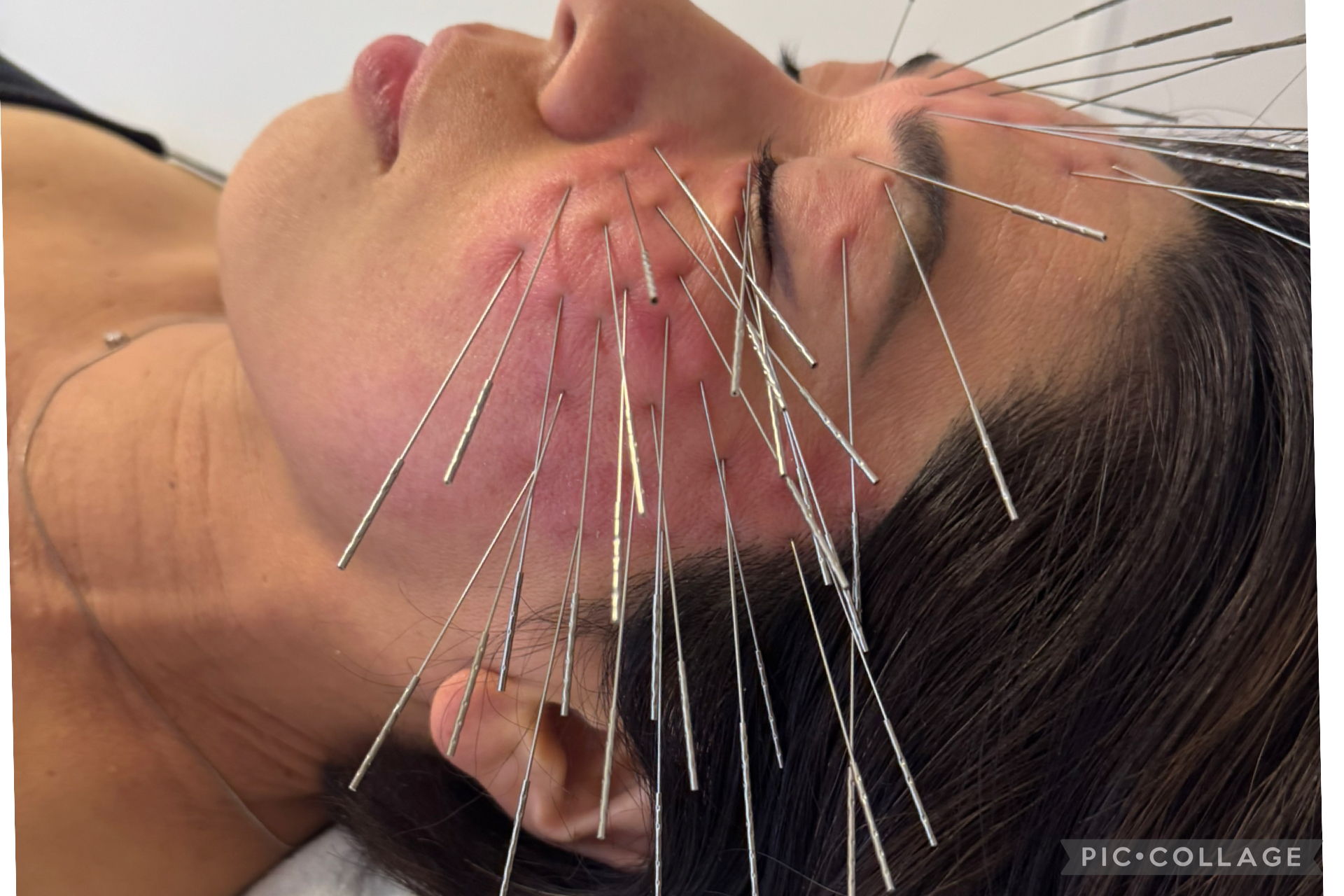 鍼処卓-taku- ｜ルート治療Sランク公認認定院｜空ルート｜浄化｜美容鍼｜吹田市 ルート鬼美容鍼のメニュー画像