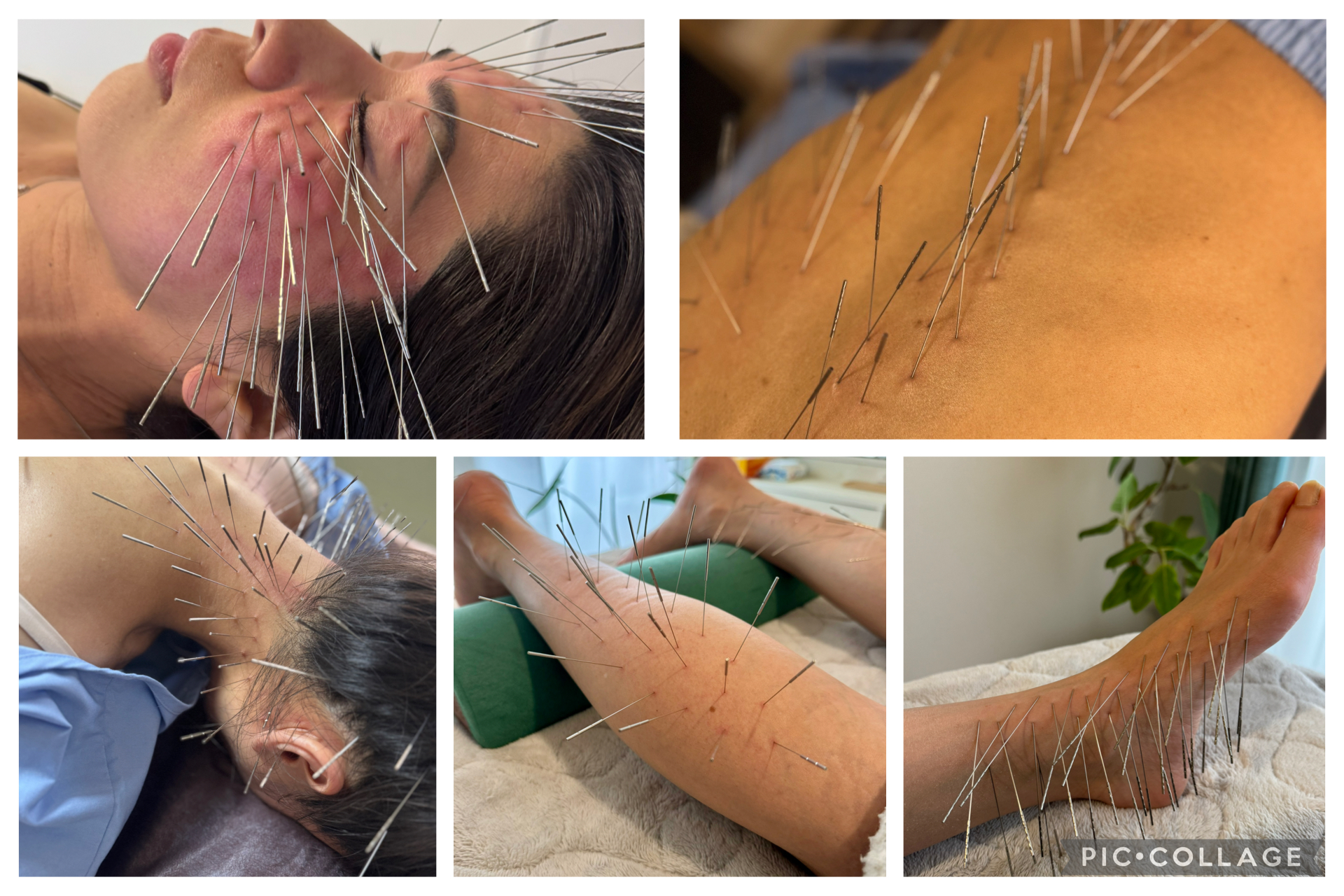 鍼処卓-taku- ｜ルート治療Sランク公認認定院｜空ルート｜浄化｜美容鍼｜吹田市 ルート鍼治療　90分のメニュー画像