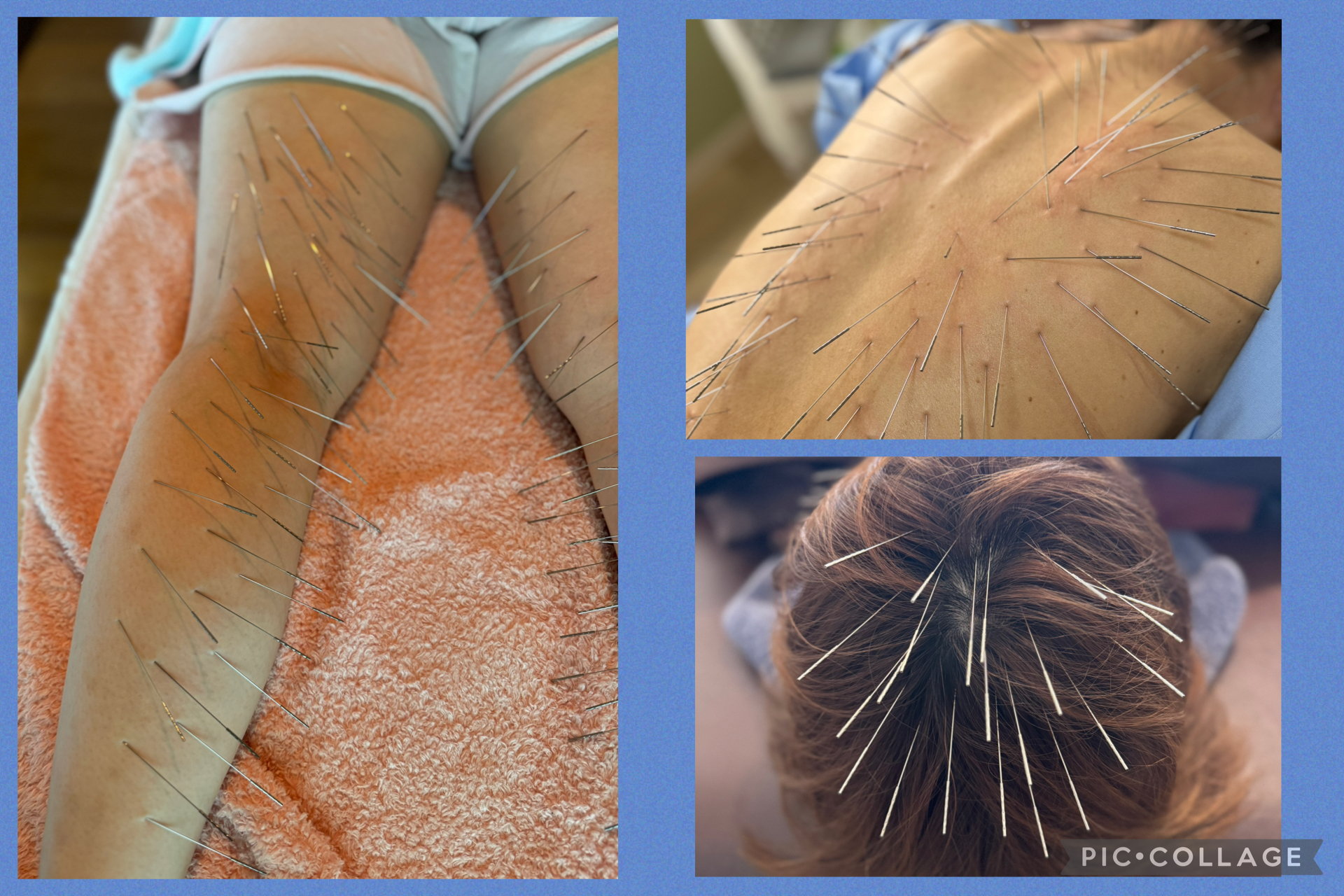 鍼処卓-taku- ｜ルート治療Sランク公認認定院｜空ルート｜浄化｜美容鍼｜吹田市 ルート鍼治療60分のメニュー画像