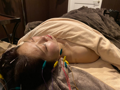 ハリスパ堀江院 リフトアップ美容鍼集中コース【頬の位置が上がり、すっきり】のメニュー画像