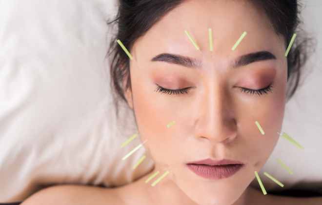 【NEW!】クイック鍼灸院さすもん クイック美顔コースのメニュー画像