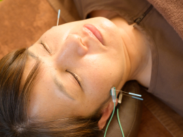 ととろはりきゅう院 たるみ改善FN美容鍼のメニュー画像