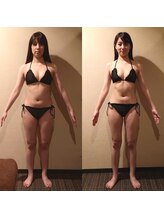 龍虎道鍼灸院 【院長施術】ダイエット鍼解禁／詰めて通える方限定メニューのメニュー画像