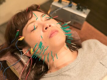 龍虎道鍼灸院 【小顔矯正＋美顔鍼50本】平日15時まで限定トライアルのメニュー画像