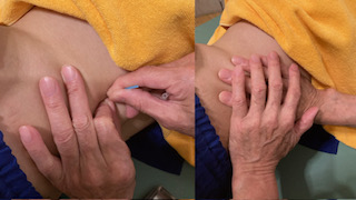 東洋堂治療院　漢方・自然薬 東洋堂 鍼・気功併用治療のメニュー画像