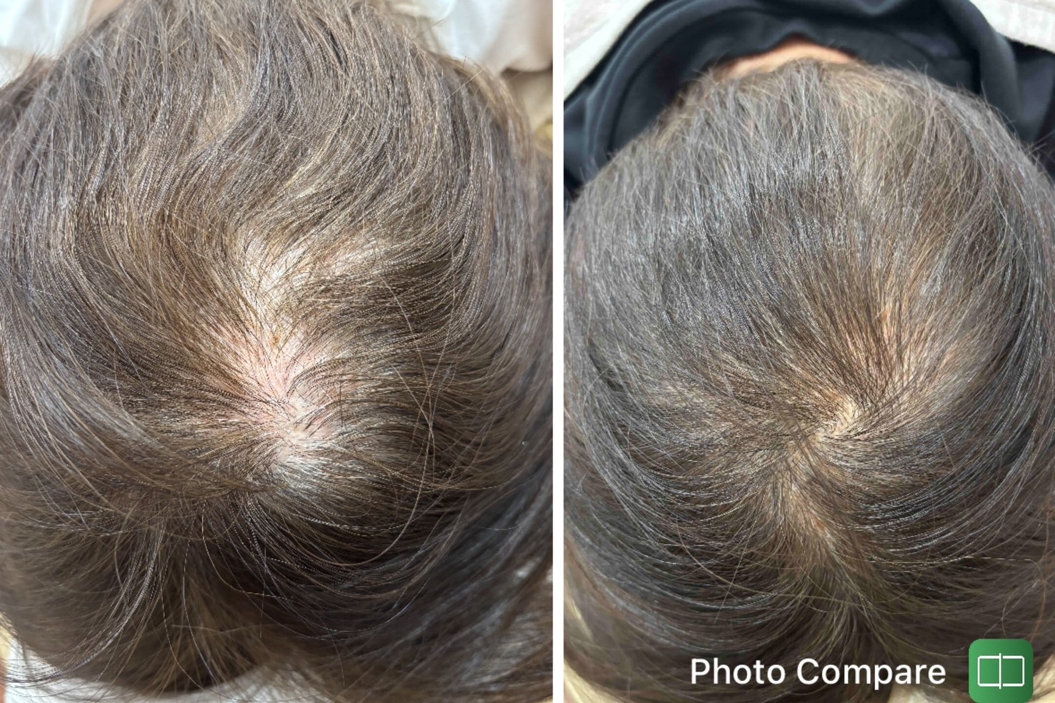 モエレ鍼灸接骨院 ルート薄毛治療のメニュー画像