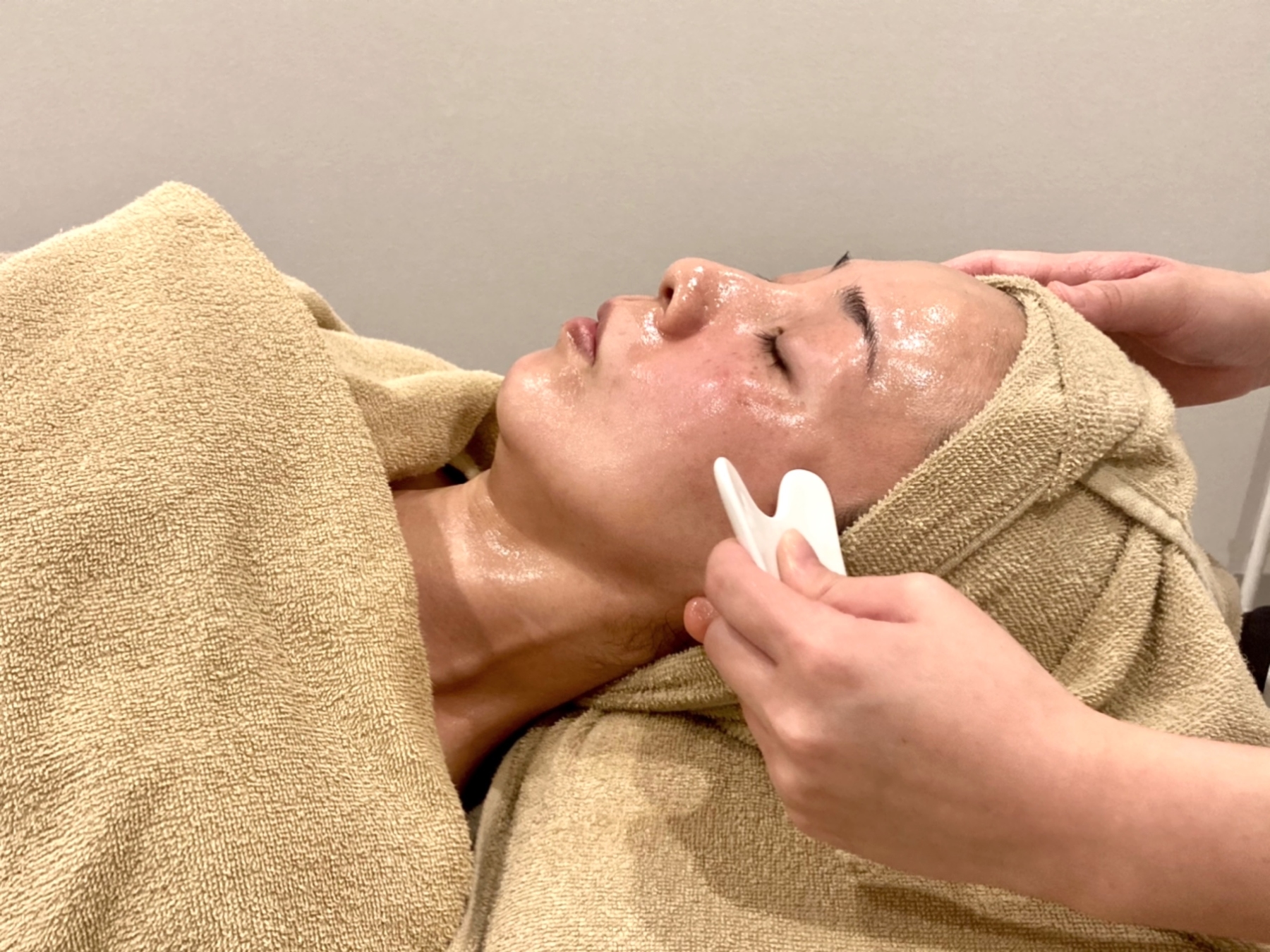 美容鍼灸サロンYURARA 毛穴リファイン美容鍼【毛穴×たるみ×ざらつきを改善】のメニュー画像