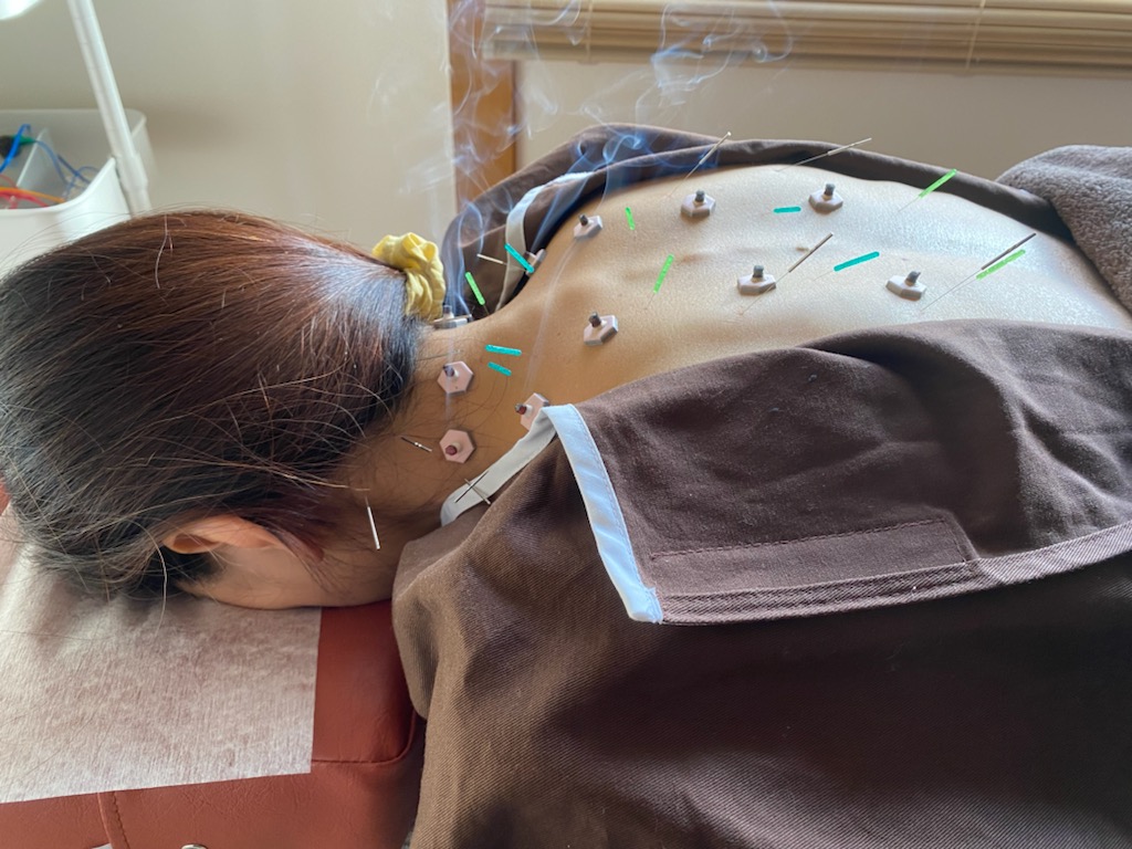 鍼灸院 侑秀 NIIGATA (新規限定)侑秀オリジナル鍼灸コースのメニュー画像