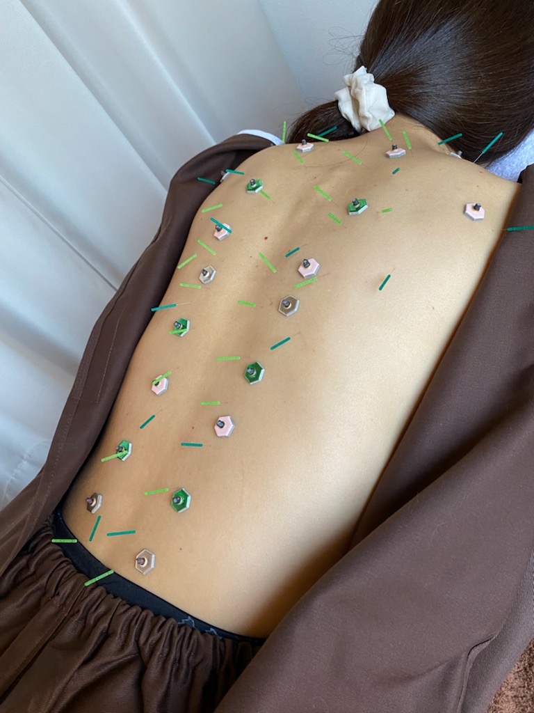 鍼灸院 侑秀 NIIGATA (新規限定)プレミアム鍼灸コースのメニュー画像