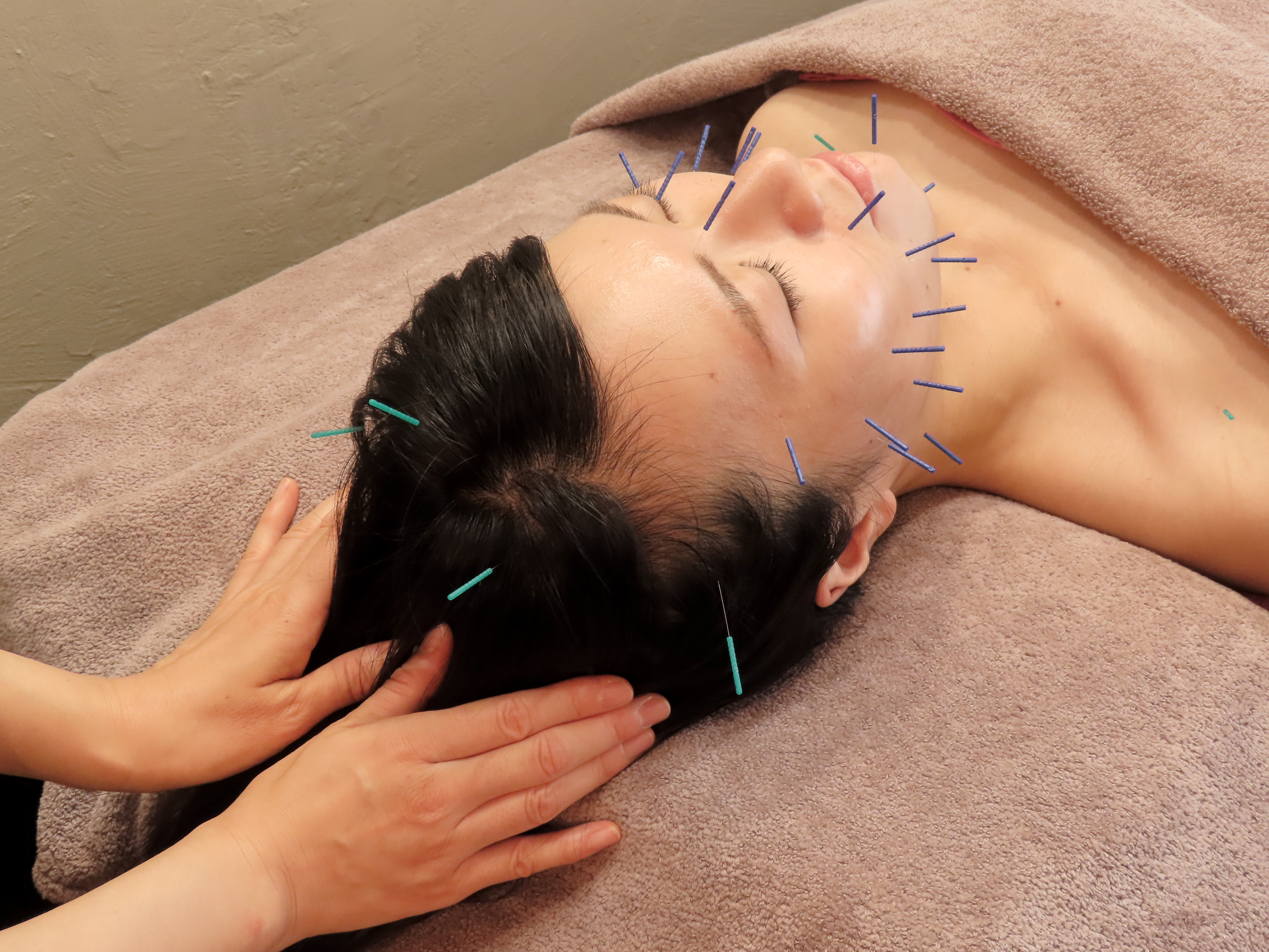 東麻布aman鍼灸サロン 【1番人気】aman全身鍼灸＋美容鍼（整体ストレッチ込み）のメニュー画像