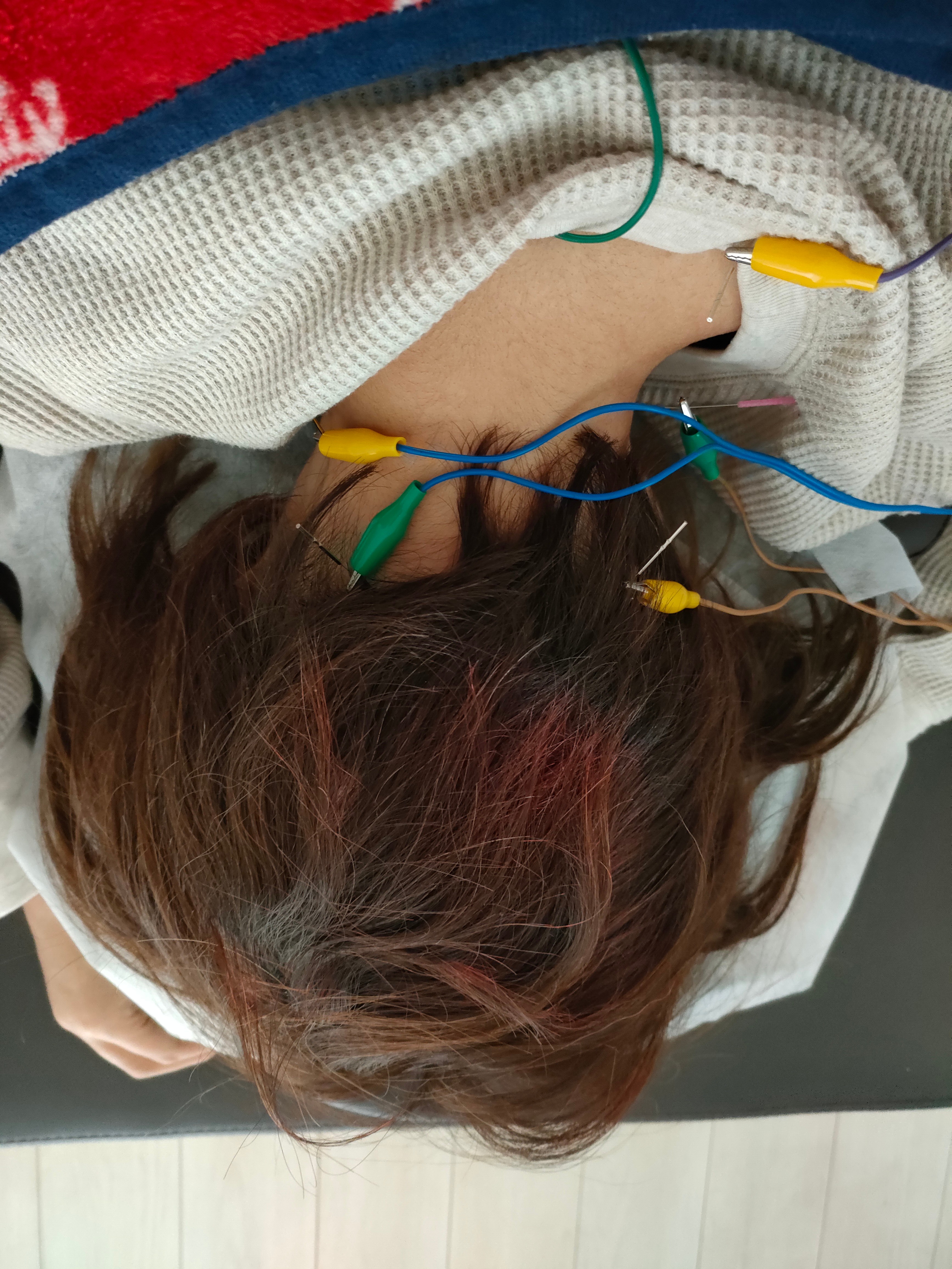 鍼灸・やました 整体60分のメニュー画像