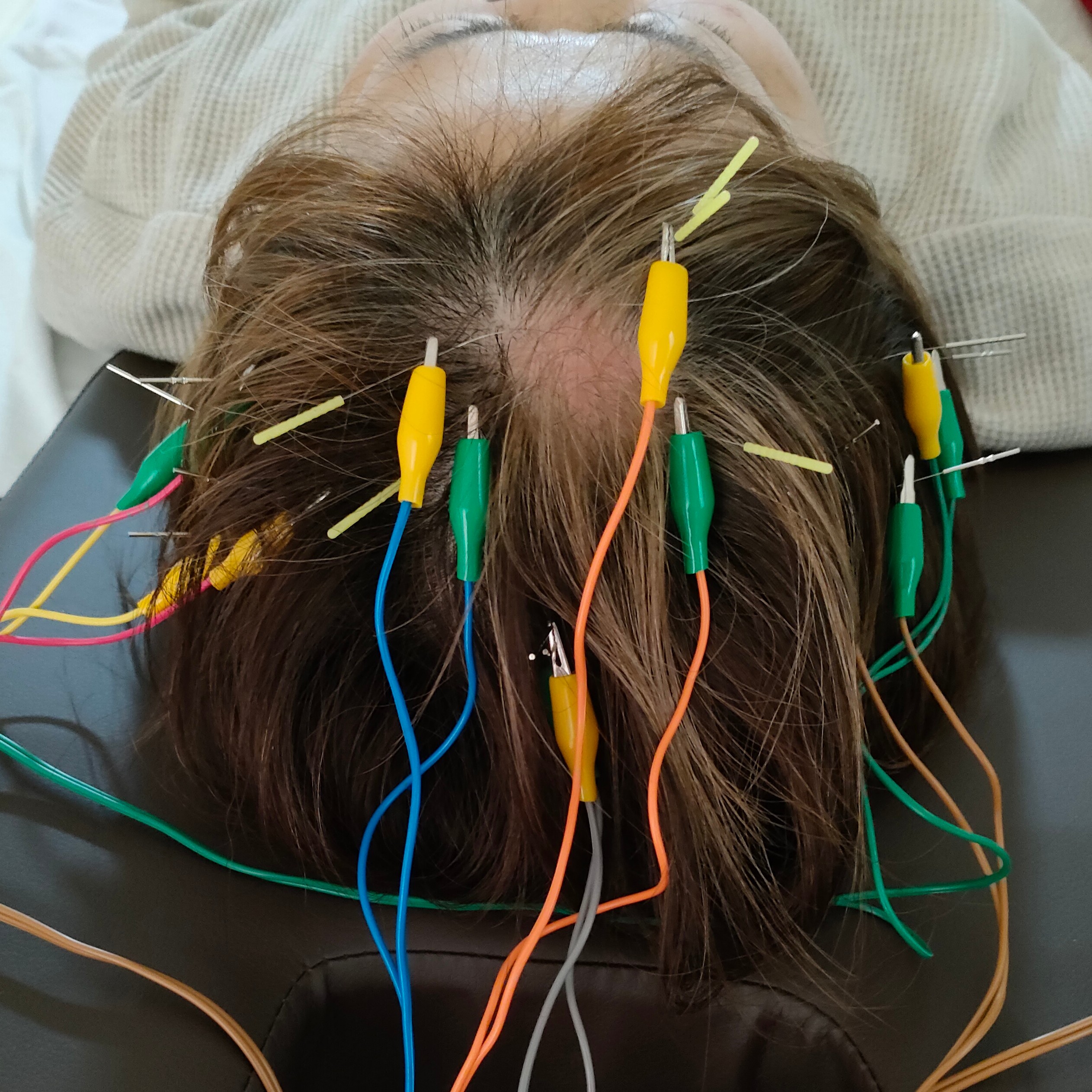 鍼灸・やました 頭髪メニューのメニュー画像