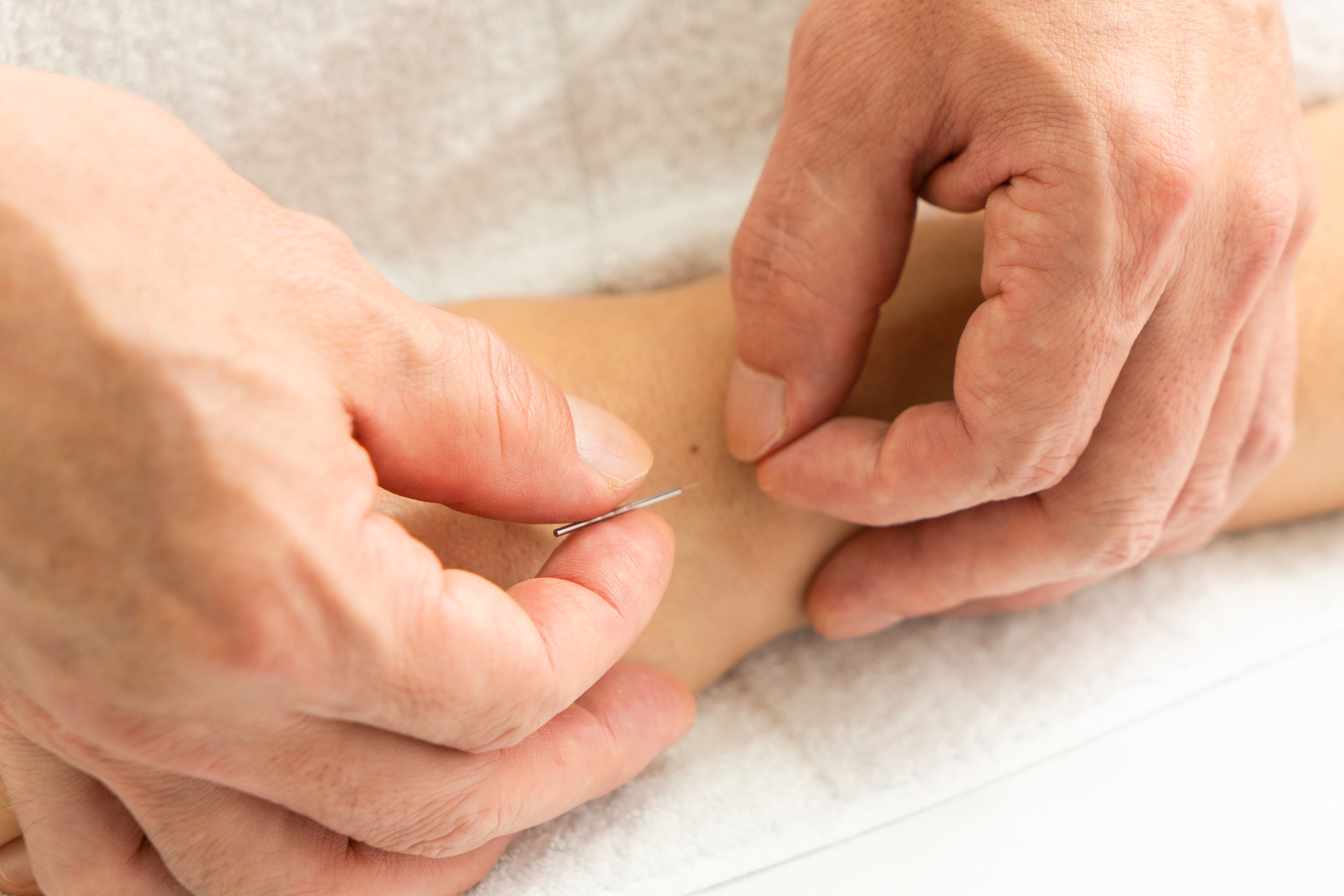 杏林堂治療院 小児鍼　小学生のメニュー画像