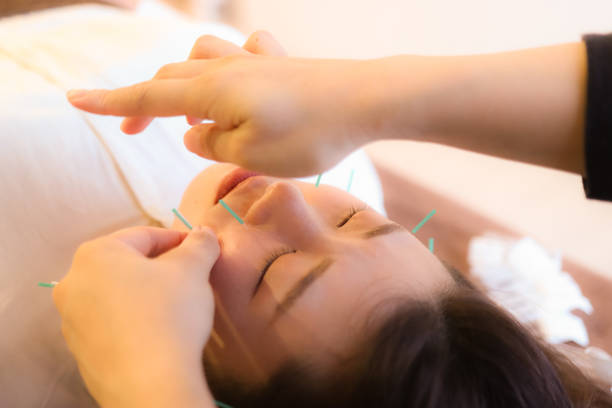 鍼灸かのあ 初回｜むくみ・たるみ印象チェンジ美容鍼 75minのメニュー画像