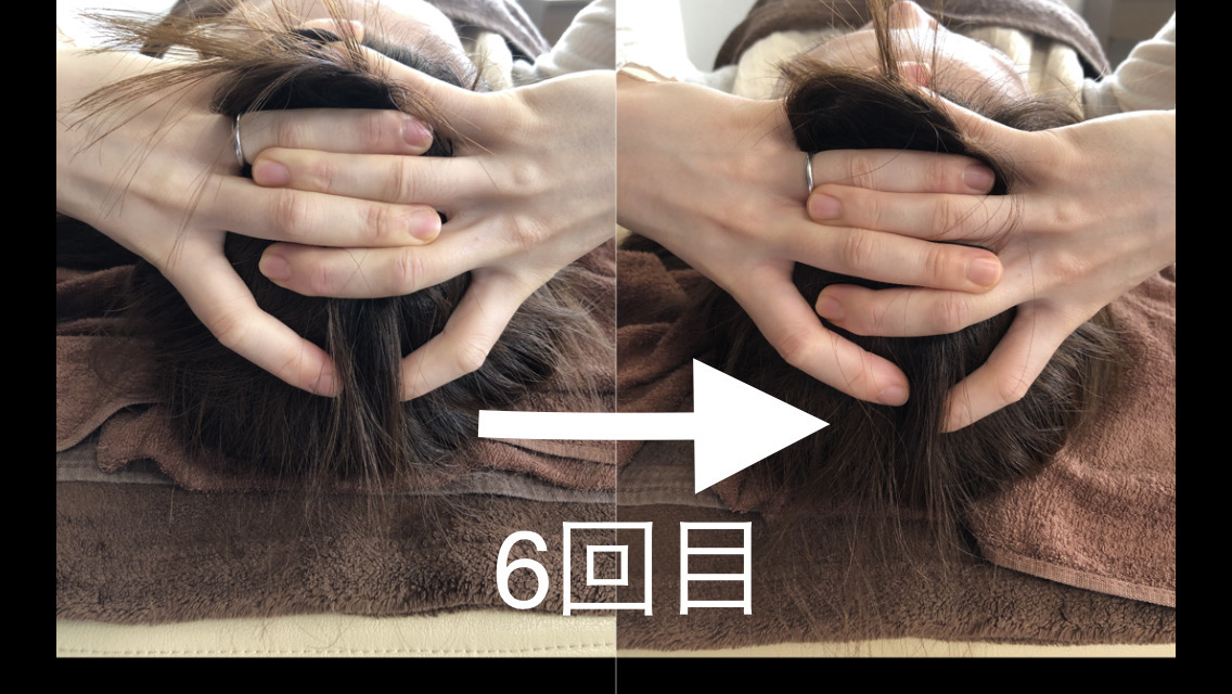 KOBE鍼灸治療院 お顔左右差歪み骨格矯正×歪み筋肉矯正のメニュー画像