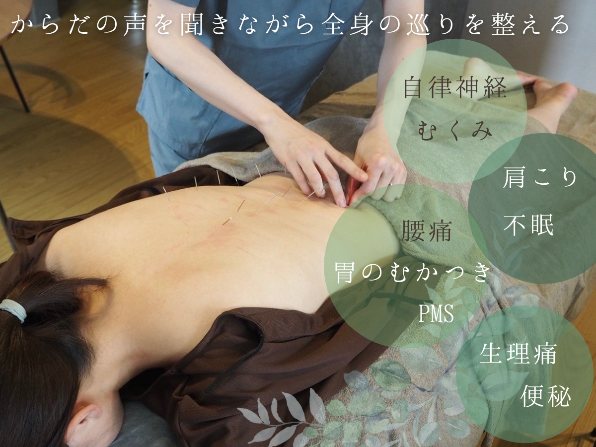 はりきゅう きざし はりきゅう（全身治療）のメニュー画像