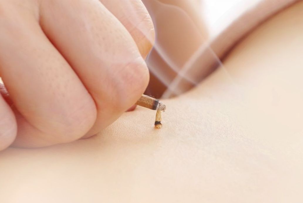 相模大野ひよこ堂鍼灸院 【全身お灸】疲労回復・リラックスのメニュー画像