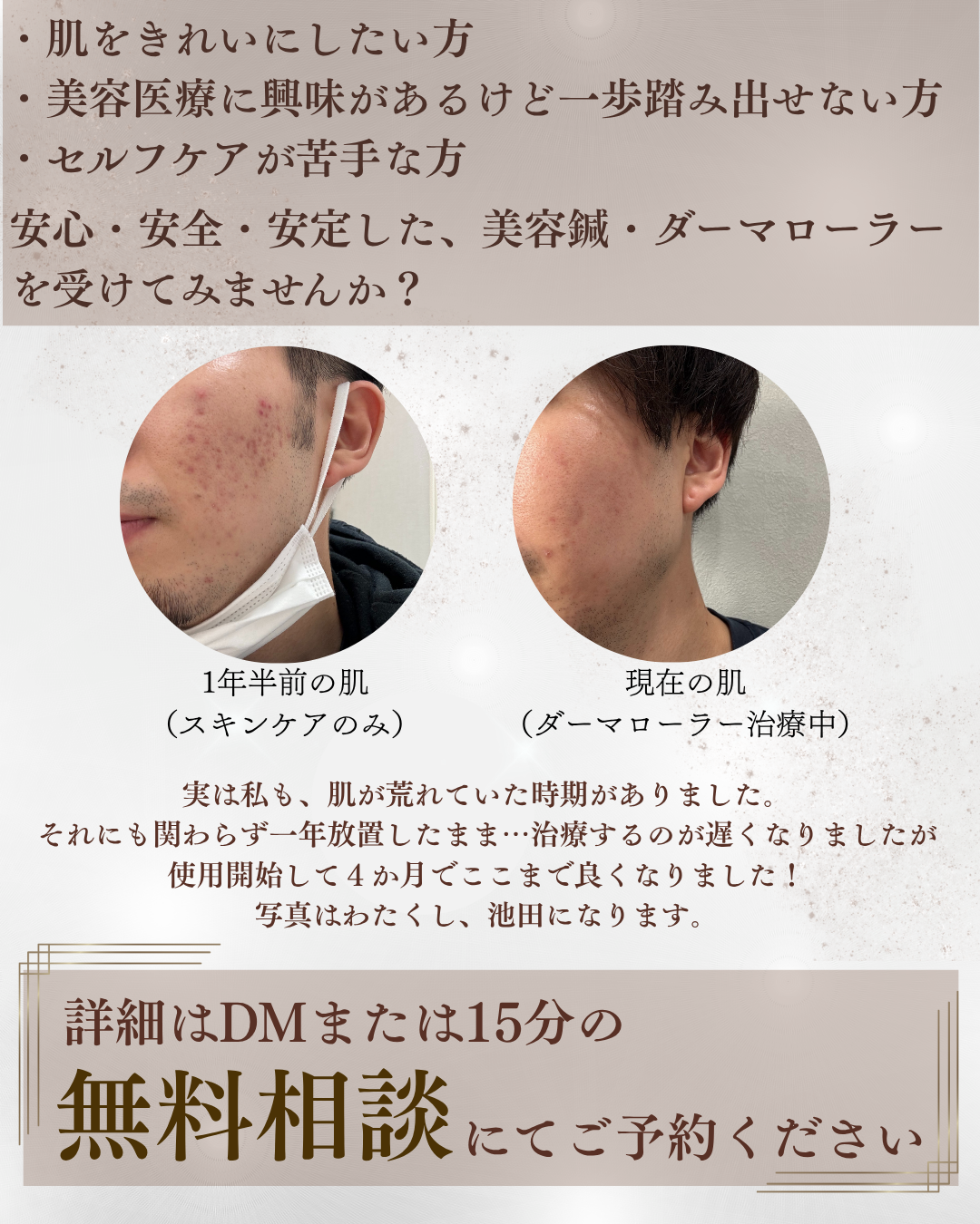 はりきゅう治療院そえ樹 【無料相談】肌質改善コースのメニュー画像