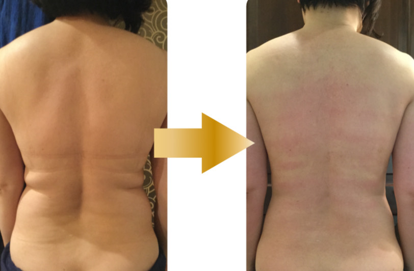 たいよう鍼灸整骨院conditioning labo(ルート治療認定院) ハイパーナイフ×メディセル無料体験のメニュー画像