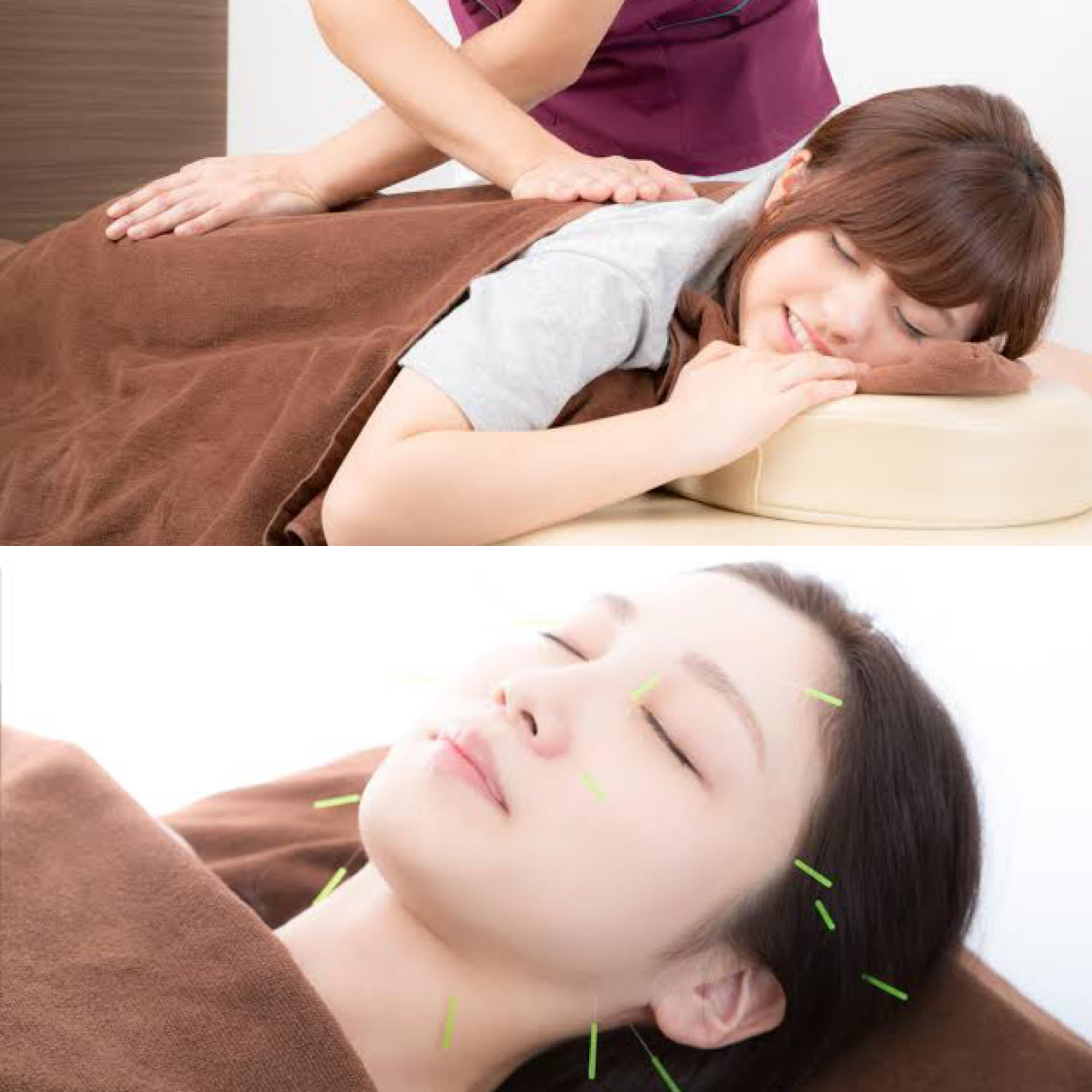 小林整骨院　上野毛 【お身体とお顔どちらも整う】整体×美容鍼　のメニュー画像