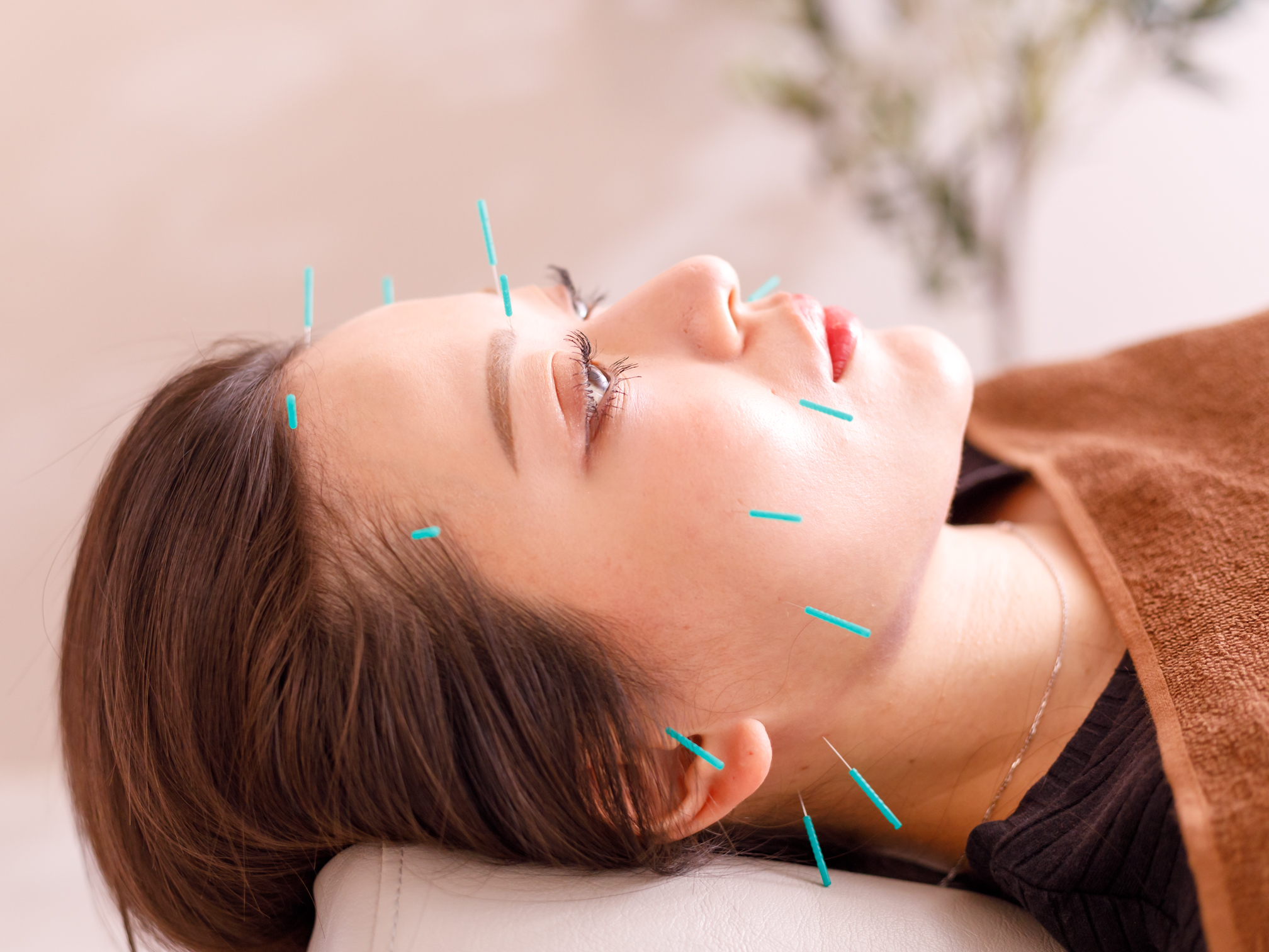 整体と美容鍼　無名 【眼精疲労特化美容鍼】瞼の重さ超回復◎　かつてない開眼力を のメニュー画像